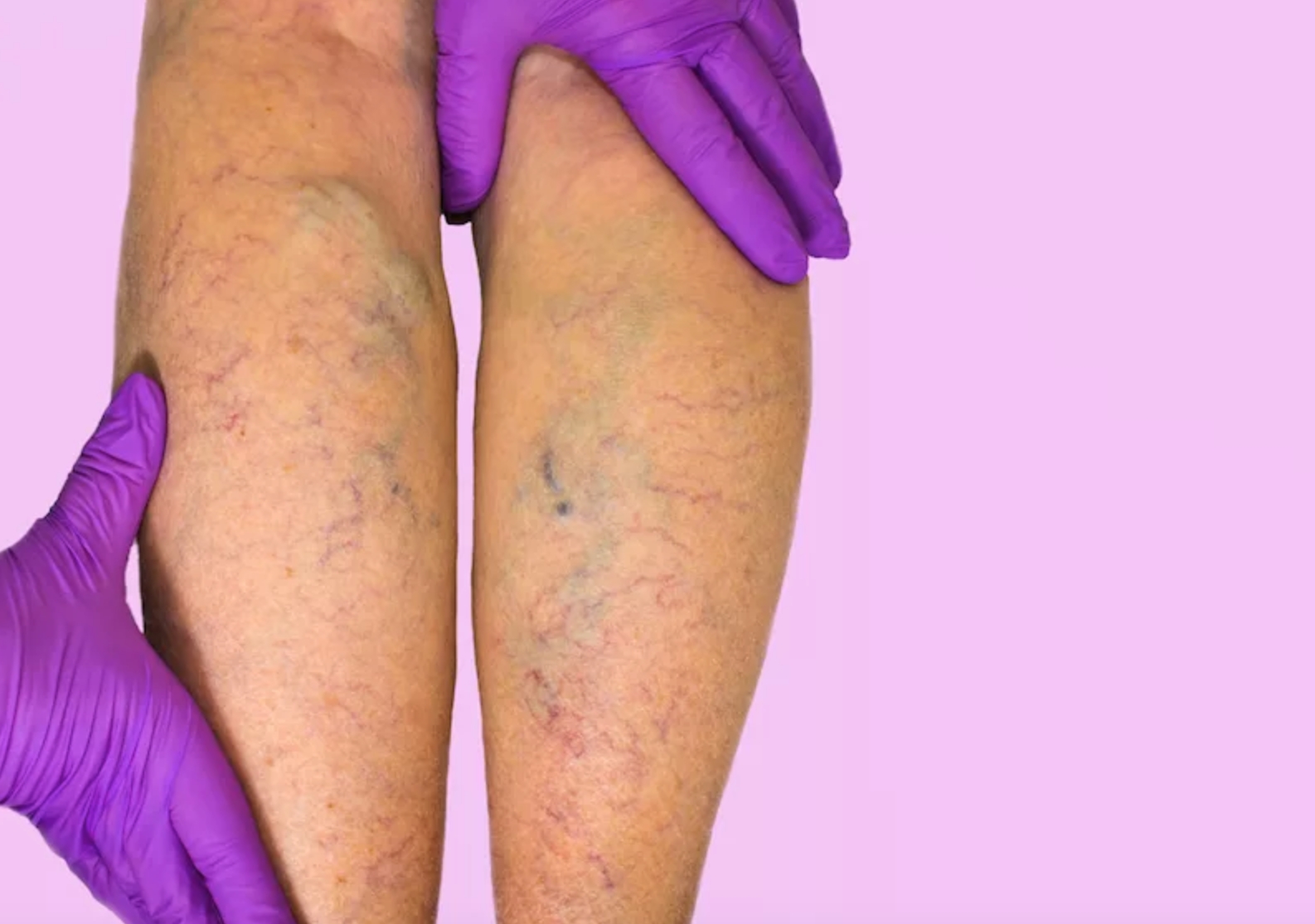 Înțelegerea presiunii arteriale